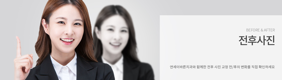 전후사진